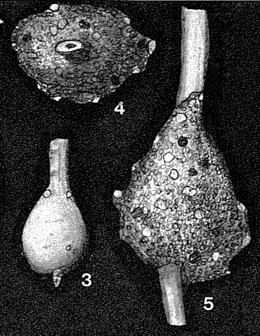 Lagenammina pyriformis Tappan, 1940 Lagenammina pyriformis Tappan, 1940