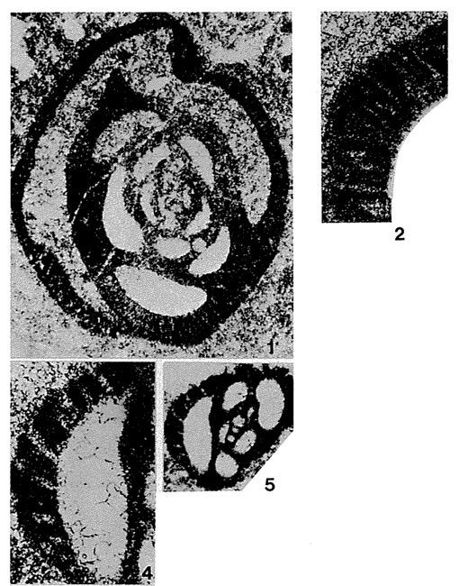 Miliolipora cuvillieri Brönnimann & Zaninetti, 1971