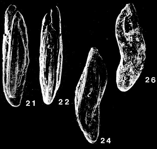 Crenulostomina banksi Quilty, 1974