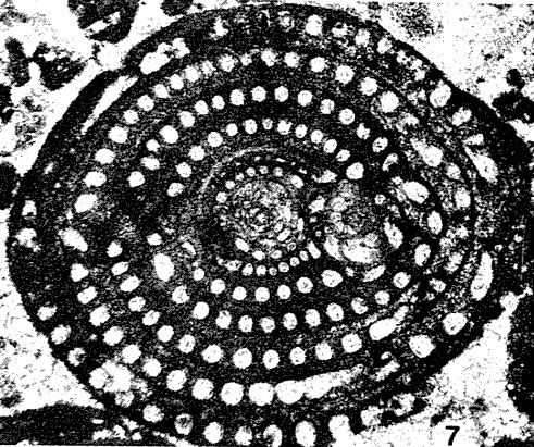 Glomalveolina dachelensis (Schwager, 1883) Glomalveolina dachelensis (Schwager, 1883)