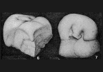 Chromista - Foraminifera (foraminifers)