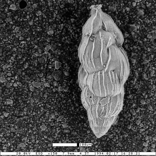 Uvigerinella californica subsp. ornata (Cushman, 1926)