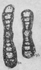 Xingshandiscus jianyangensis Zheng, 1986