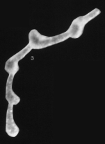 Calos chalazius Schröder, Medioli & Scott, 1989