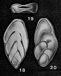 Berthelinella paradoxa (Berthelin, 1879) Berthelinella paradoxa (Berthelin, 1879)