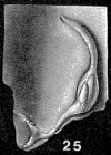 Globulina redriverensis Tappan, 1943