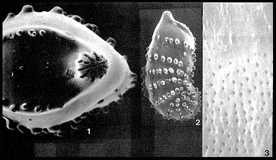 Percultazonaria subaculeata (Cushman, 1923)