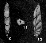 Pseudosaracenaria truncata Venkatachalapathy, 1968