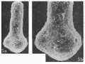 Chromista - Foraminifera (foraminifers)