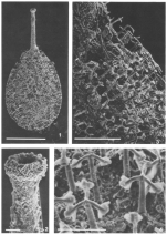 Nanosylvanella palmulina Patterson, 1990