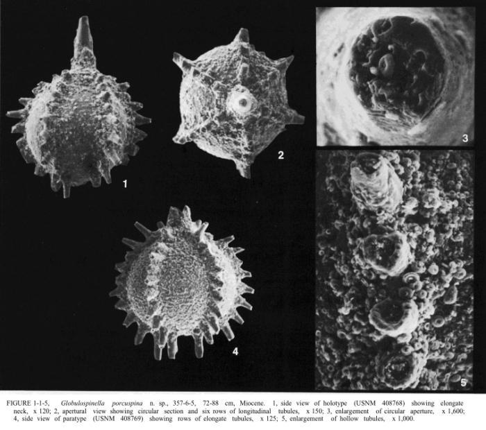Globulospinella porcuspina Patterson, 1988 Globulospinella porcuspina Patterson, 1988