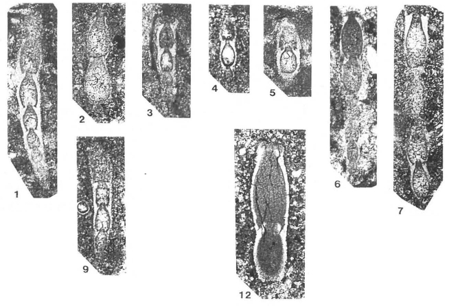 Vervilleina bradyi (Spandel, 1901) Vervilleina bradyi (Spandel, 1901)