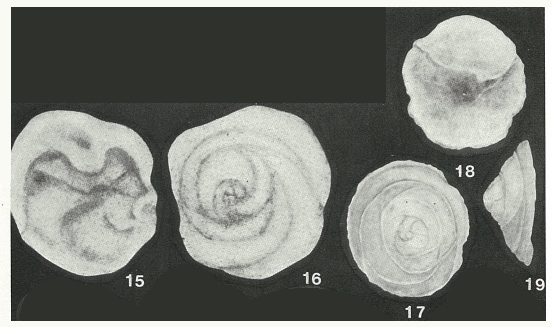 Patellovalvulina patruliusi Neagu, 1975