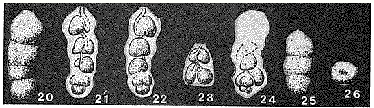 Pseudoreophax cisovnicensis Geroch, 1961