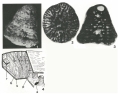 Chromista - Foraminifera (foraminifers)