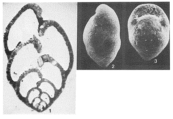 Bannerella gibbosa (d'Orbigny, 1826)