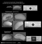 Bythocypris reniformis Brady, 1880 - Lectotype and Paralectotypes from the type locality