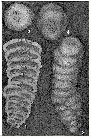 Cribrogoesella robusta (Brady, 1881)