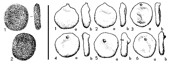 Placentammina placenta (Grzybowski, 1898) Placentammina placenta (Grzybowski, 1898)