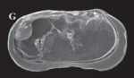 Ilyocypris tibeta Peng, Zhai, Smith, Wang, Guo & Zhu, 2021 — Holotype interior view from original paper