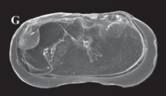 Ilyocypris tibeta Peng, Zhai, Smith, Wang, Guo & Zhu, 2021 — Holotype interior view from original paper