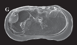 Ilyocypris tibeta Peng, Zhai, Smith, Wang, Guo & Zhu, 2021 — Holotype interior view from original paper