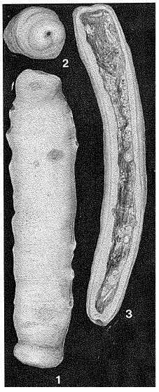 Hippocrepinella hirudinea Heron-Allen & Earland, 1932 Hippocrepinella hirudinea Heron-Allen & Earland, 1932