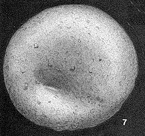 Thuramminoides sphaeroidalis Plummer, 1945 Thuramminoides sphaeroidalis Plummer, 1945