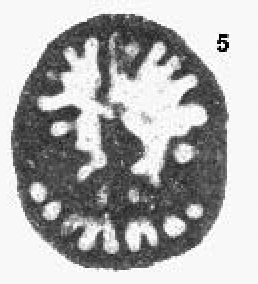 Trochamijiella gollesstanehi Athersuch, Banner & Simmons, 1992