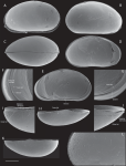 Sarscypridopsis denticulata Smith & Ozawa, 2023 - SEM valves images from original paper