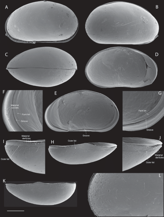 Sarscypridopsis denticulata Smith & Ozawa, 2023 - SEM valves images from original paper Sarscypridopsis denticulata Smith & Ozawa, 2023 - SEM valves images from original paper