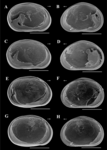 Brasilocypria pea De Almeida, Ferreira, Martens & Higuti, 2023 - SEM valves images from original paper