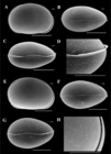 Brasilocypria pea De Almeida, Ferreira, Martens & Higuti, 2023 - SEM valves images from original paper