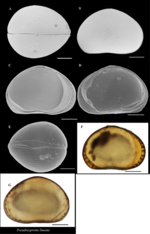 Pseudocypretta lineata Ma & Yu, 2020 - Valves images from original paper