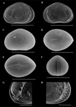 Pseudocypretta amor Ferreira, Almeida, Higuti & Martens, 2022 - SEM carapace and valves images from original paper