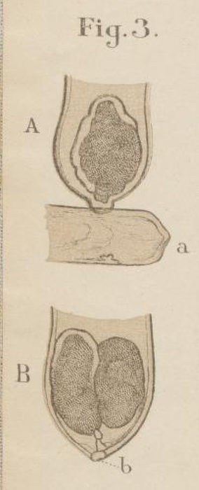 First Illustration of Tintinnus borealis, now known to be a peritrich ciliate, not a tintinnid ciliate First Illustration of Tintinnus borealis, now known to be a peritrich ciliate, not a tintinnid ciliate