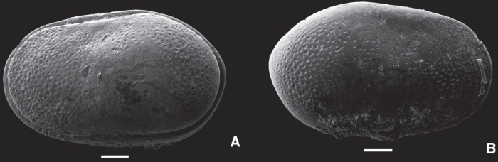 Cytherella saraballentae Ceoli, Whatley, Fauth & Concheyro, 2015 - SEM from Holotype from original paper