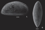 Paracypris bertelsae Paracypris bertelsae - SEM from Holotype from original paper