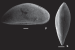 Paracypris imaguncula Ceolin & Whatley, 2015 - SEM from Holotype from original paper