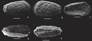 Keijia circulodictyon Ceolin & Whatley, 2015 - SEM valves images from original paper