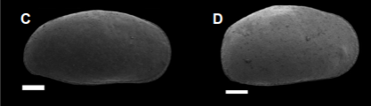 Cyprideis salebrosa hartmanni Ramirez, 1967