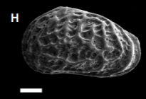 Callistocythere litoralensis (Rossi de García) 1966 