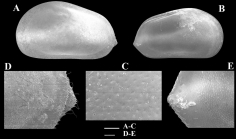 Hungarocypris suranareeae Savatenalinton & Suttajit, 2016 - SEM valves images from original paper