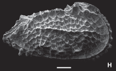 Orthrocosta atopos Ceolin & Whatley, 2015 - SEM valves images from original paper