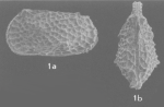 Bradleya argentinensis Bertels, 1975 - Holotype SEM valves from original paper