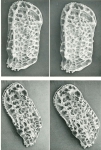 Holotype of Quasibradleya plicocarinata Benson, 1972