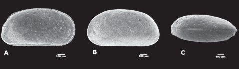 Holotype of Fossocytheridea posterodentata Bergue, Fauth, Vieira, Santos & Viviers, 2011