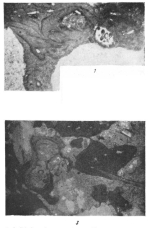 Tubiphytes obscurus Maslov, 1956