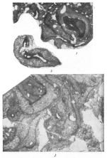 Tubiphytes obscurus Maslov, 1956