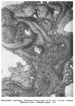 Tubiphytes obscurus Maslov, 1956